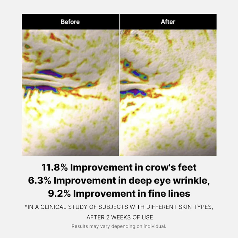 Deep Lifting Peptide Eye Cream medicube France
