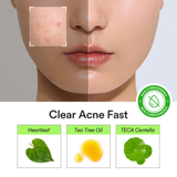 Heartleaf Calming Spot Patch