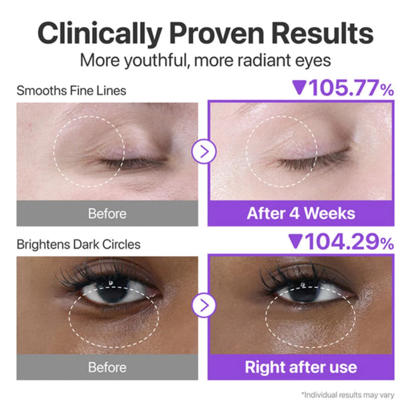 NAD+ Retinol Volumetox Eye Cream Numbuzin France