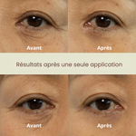 Dual Effect Eye Cream Nine Less France