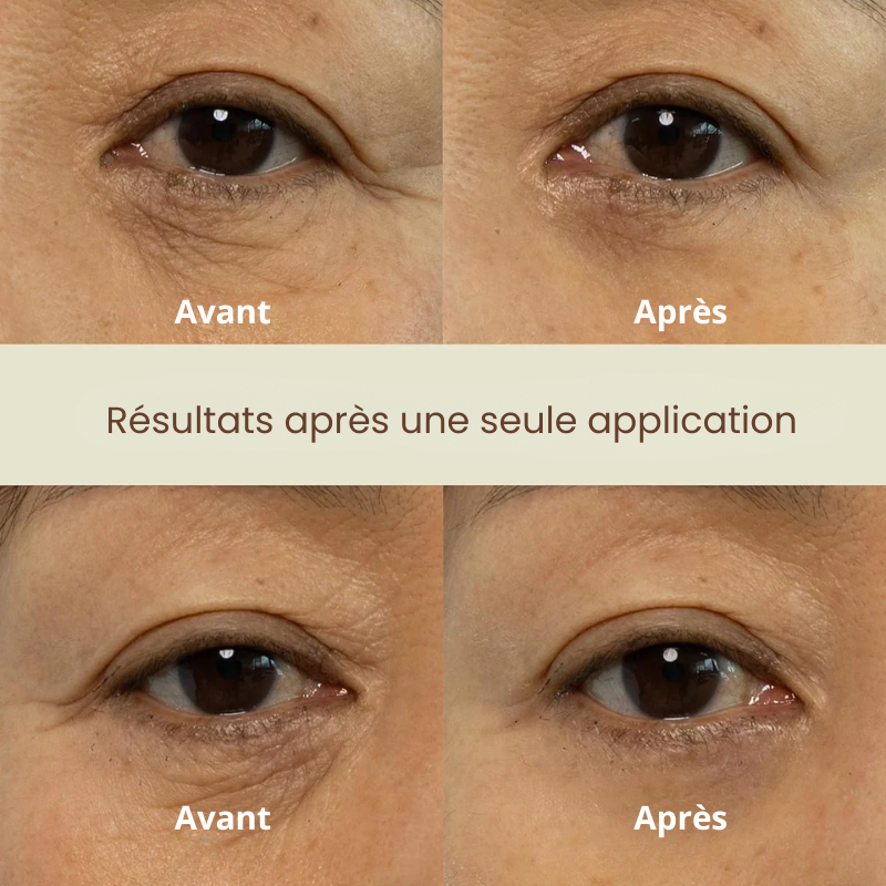 Dual Effect Eye Cream Nine Less France