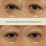 Dual Effect Eye Cream Nine Less France