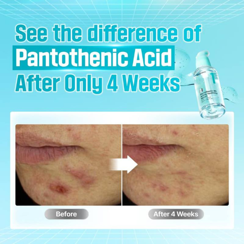 No.1 Pantothenic B5 Active Soothing Serum Numbuzin France
