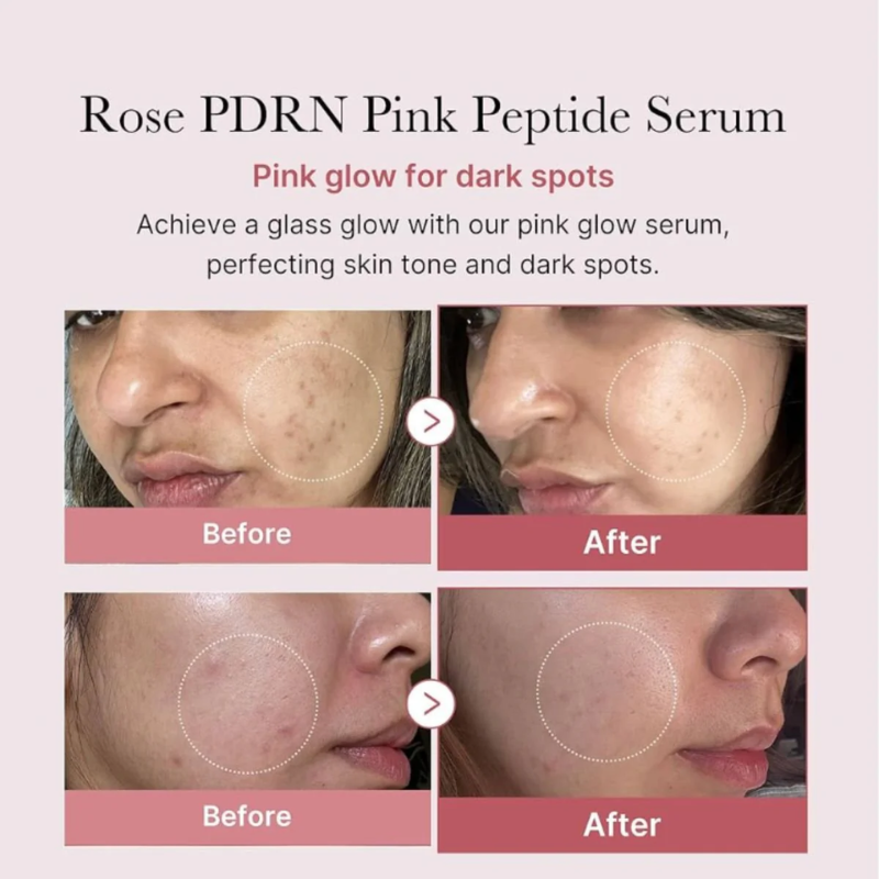 PDRN Pink Peptide Serum Medicube France