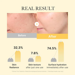 Kojic Acid Turmeric Brightening Gel Mask France