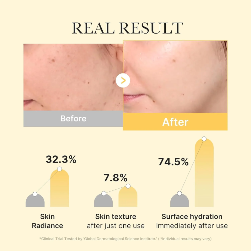Kojic Acid Turmeric Brightening Gel Mask France