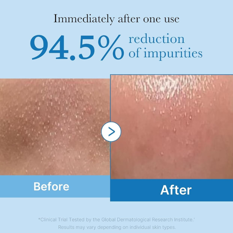 Zero Pore Blackhead Deep Cleansing Oil Medicube France