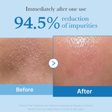 Zero Pore Blackhead Deep Cleansing Oil Medicube France