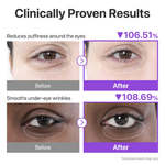 No.9 NAD+ Collagen Under Eye Patches Numbuzin France