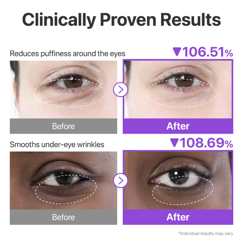 No.9 NAD+ Collagen Under Eye Patches Numbuzin France