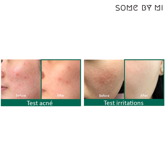 30 days Miracle Some By Mi